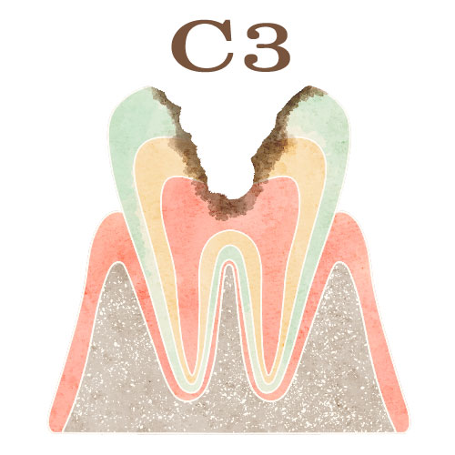 C3